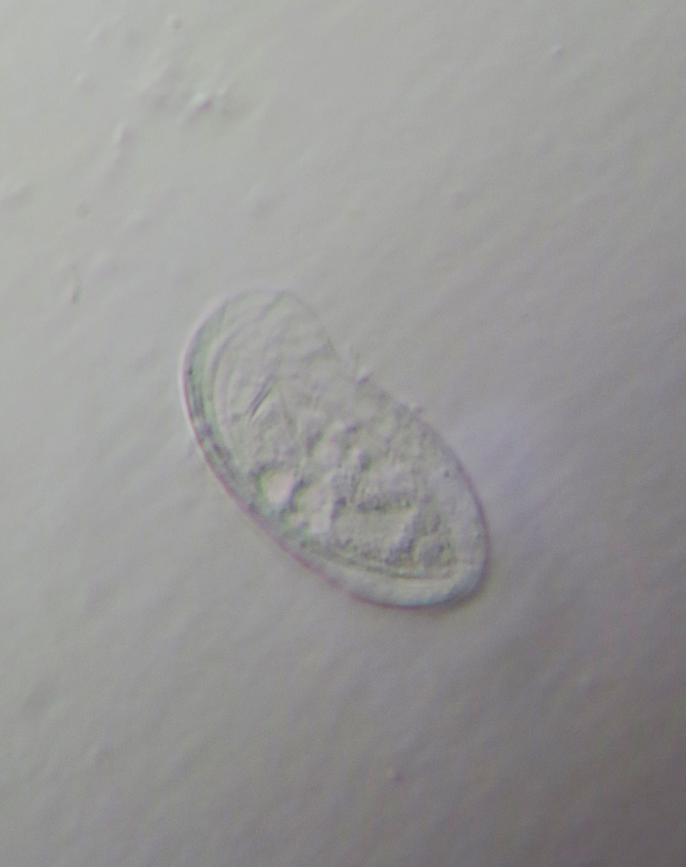 斜管虫病